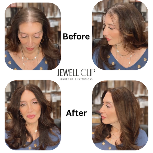 Hairline Topper- Clip Free