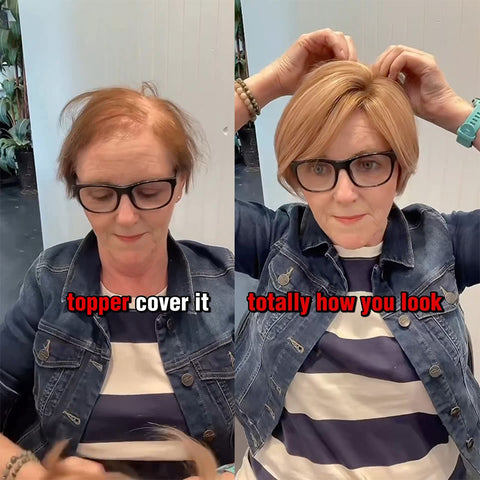 Breathable and Natural Hair Topper for Women with thinning hair
