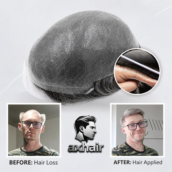 0.04–0.06mm V-Loop Ultra Thin Skin Hair System – Knotless Natural Hairline & Invisible Finish