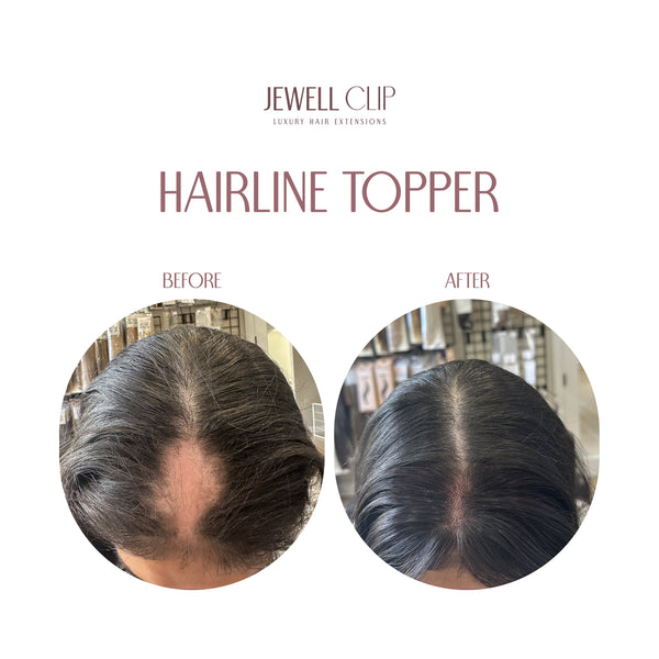Hairline Topper- Clip Free