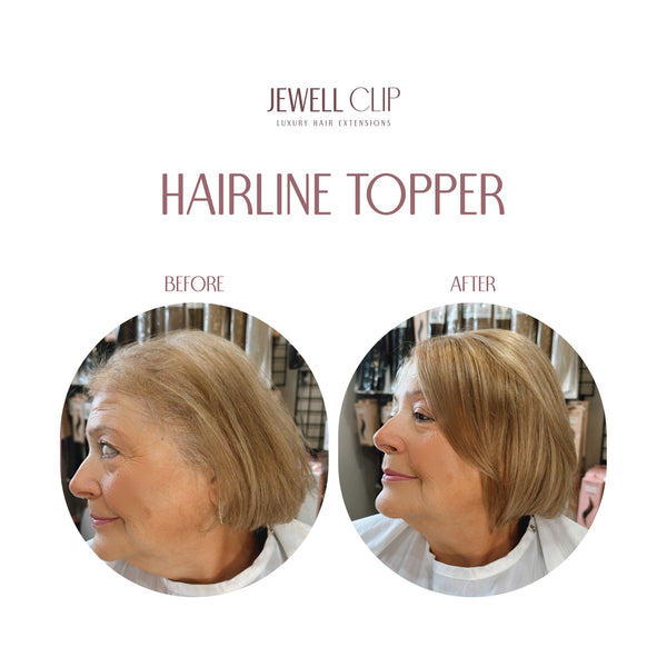 Hairline Topper- Clip Free